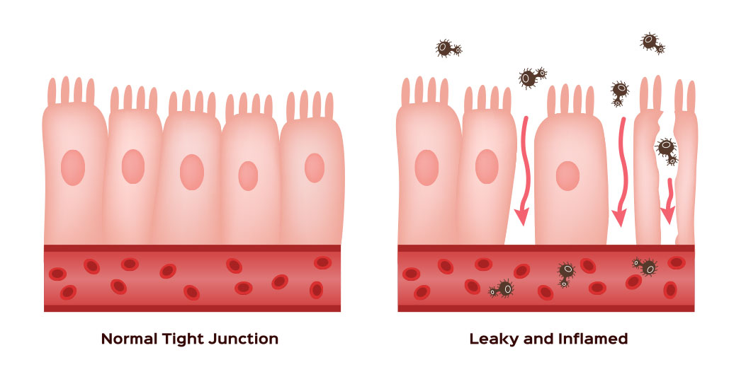 rappresentazione stato permeabilità intestinale