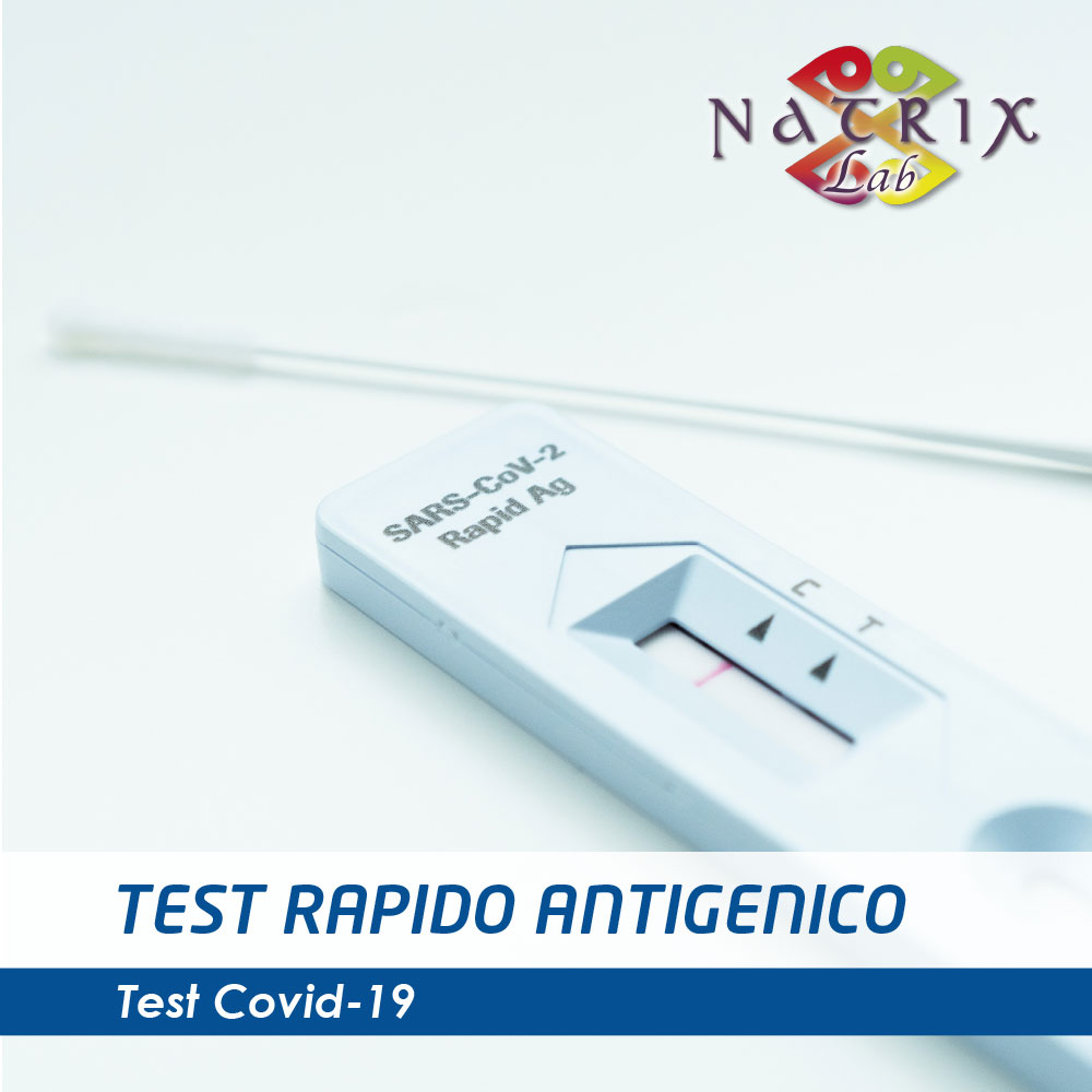 cassetta test rapido antigenico