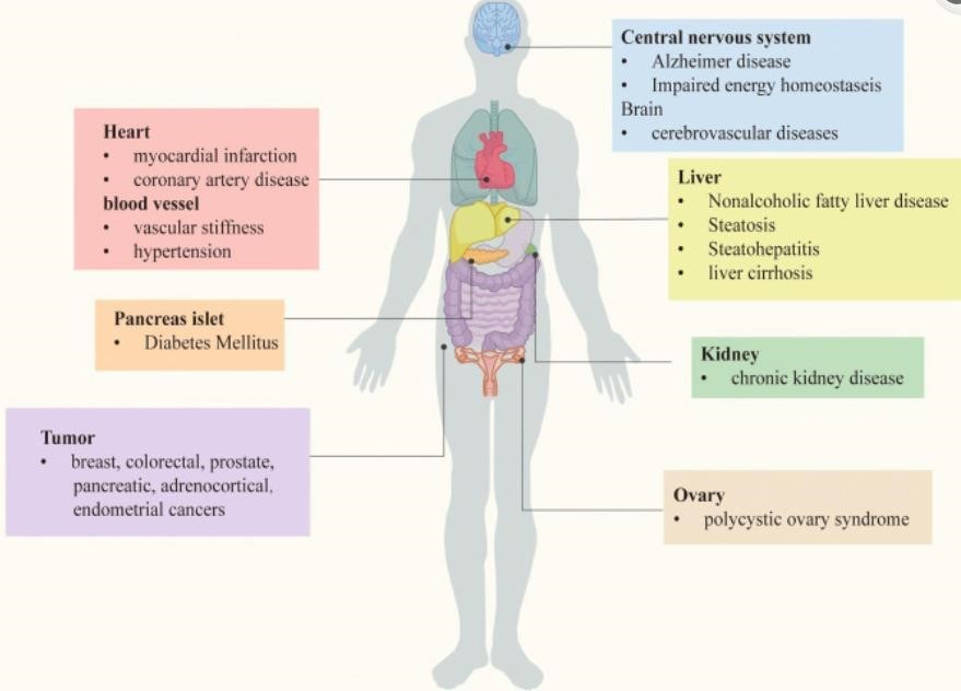 malattie metaboliche correlate all'insulino resistenza